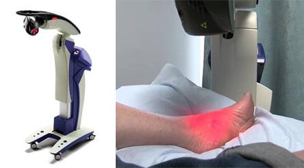 LASER THERAPY